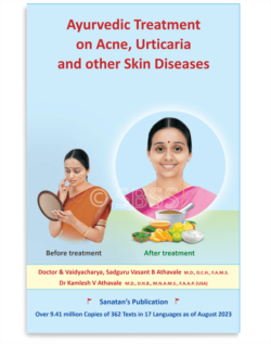 Ayurvedic Treatment on Acne, Urticaria and other Skin Diseases